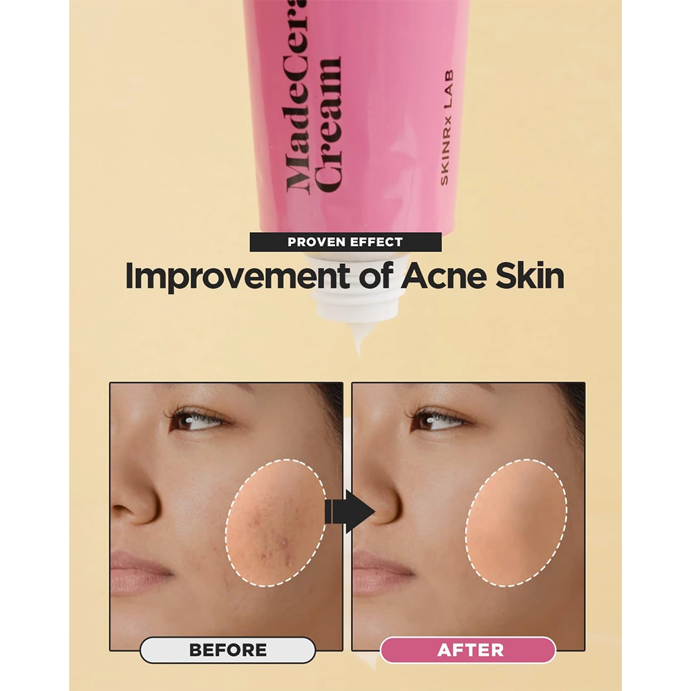 MadeCera Moisturizing Cream | Hydrating & Replenishing Facial Moisturizer for Sensitive Skin - 50ml - Image 3